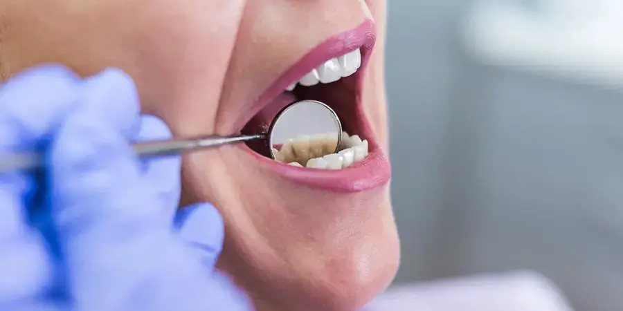 dental-problems-after-bariatric-surgery-1