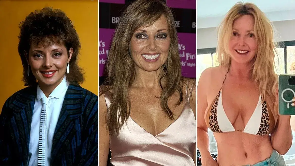 Carol Vorderman Before After Plastic Surgery - Mayclinik