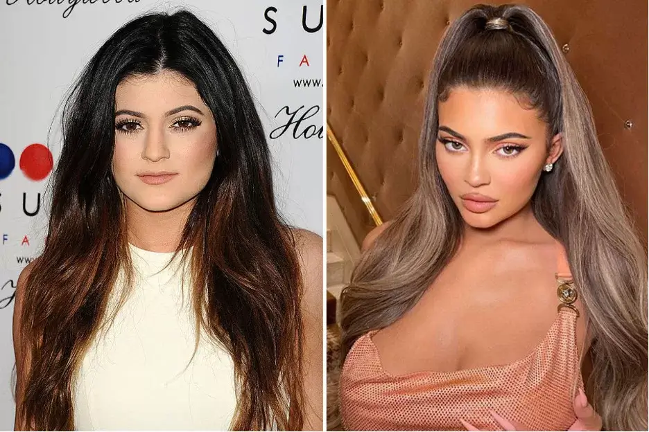 Kylie Jenner's doctor discusses her changing face