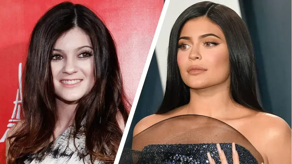 Kylie Jenner's doctor discusses her changing face