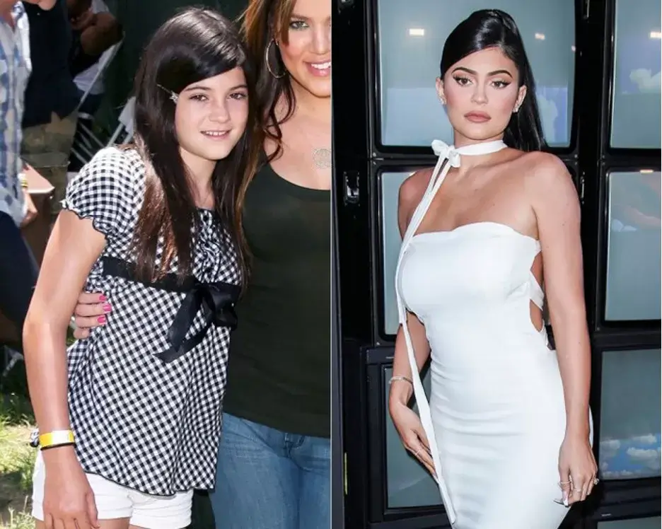 Kylie Jenner BBL: Is It Real Or Fake?