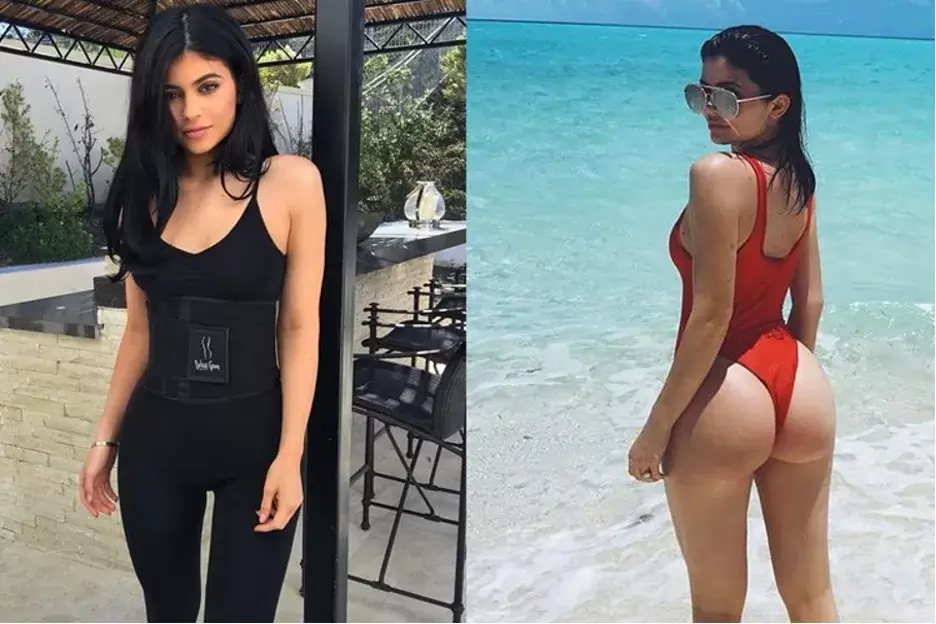 Kylie Jenner 'reversed her BBL,' fans claim as star's butt appears