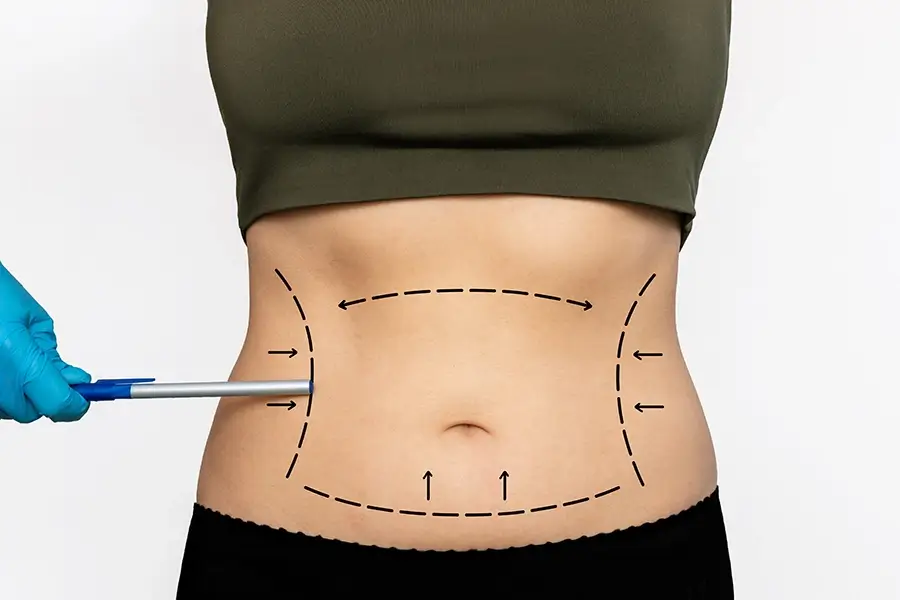 lipo*4