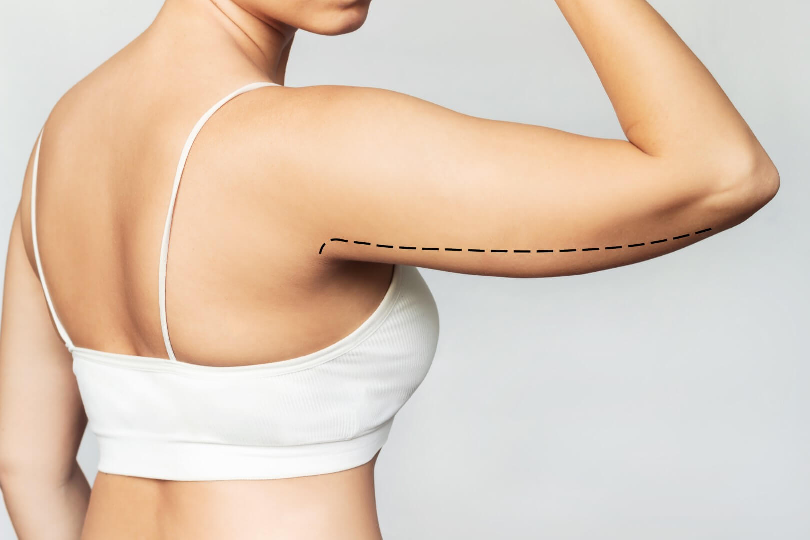 cropped-shot-young-woman-with-excess-fat-her-upper-arm-with-marks-liposuction-surgery (Büyük) cropped-shot-young-woman-with-excess-fat-her-upper-arm-with-marks-liposuction-surgery (Büyük)