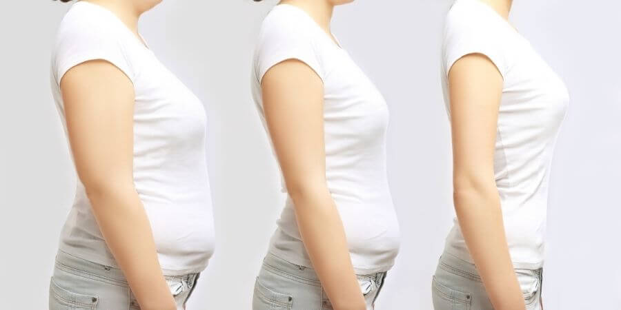 Can You Get Pregnant After Weight Loss Surgery