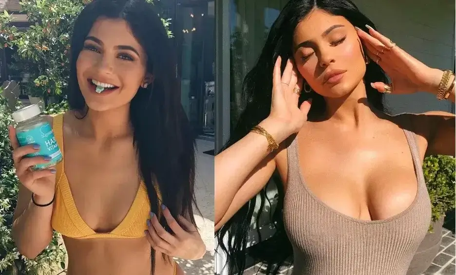 KylieJenner Before and After