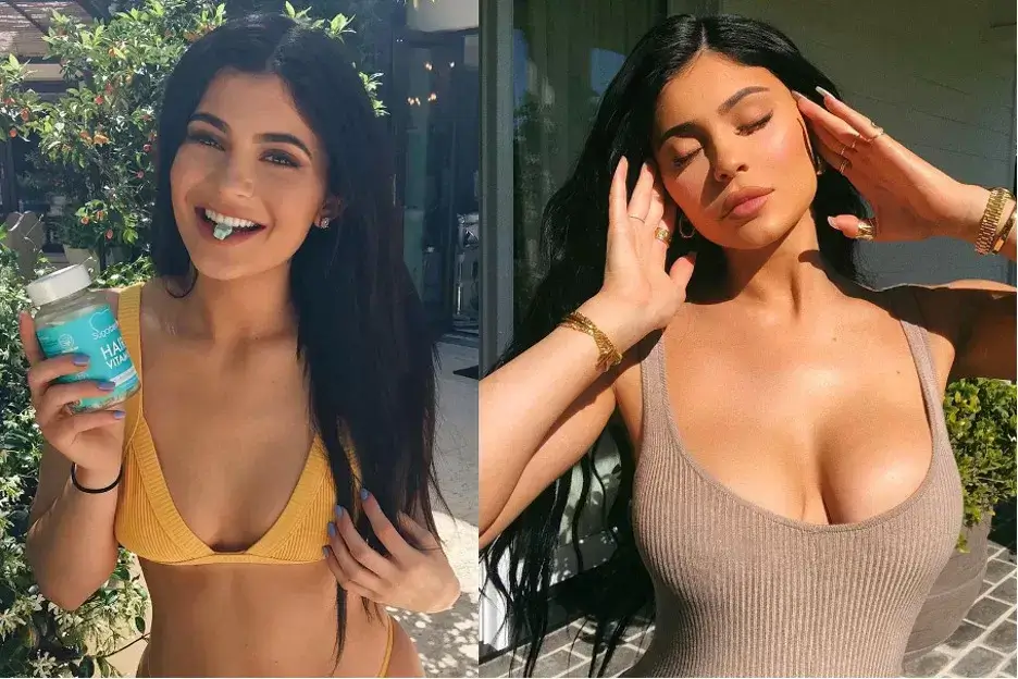 KylieJenner Before and After