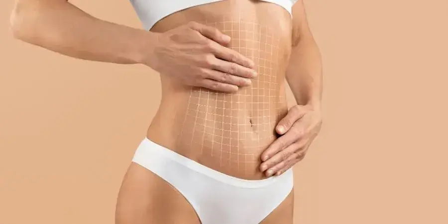 Is-It-Safe-to-Get-a-Tummy-Tuck-in-Turkey.webp Is-It-Safe-to-Get-a-Tummy-Tuck-in-Turkey.webp