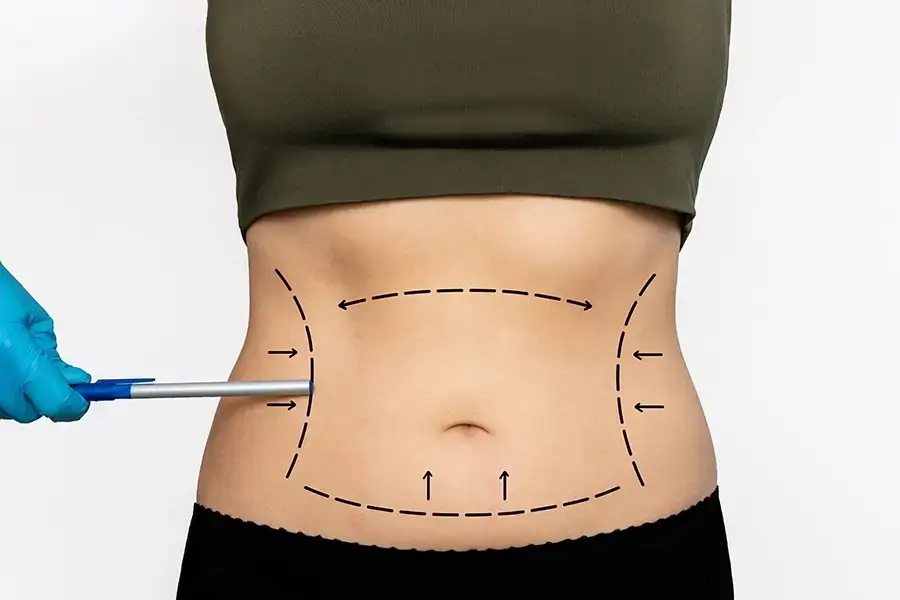 lipo4.webp lipo4.webp