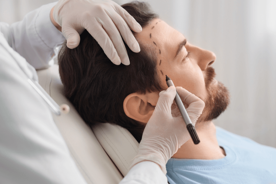 DHI Hair Transplant
